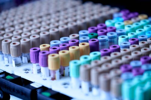 Blood sample tubes arranged in a laboratory tray.